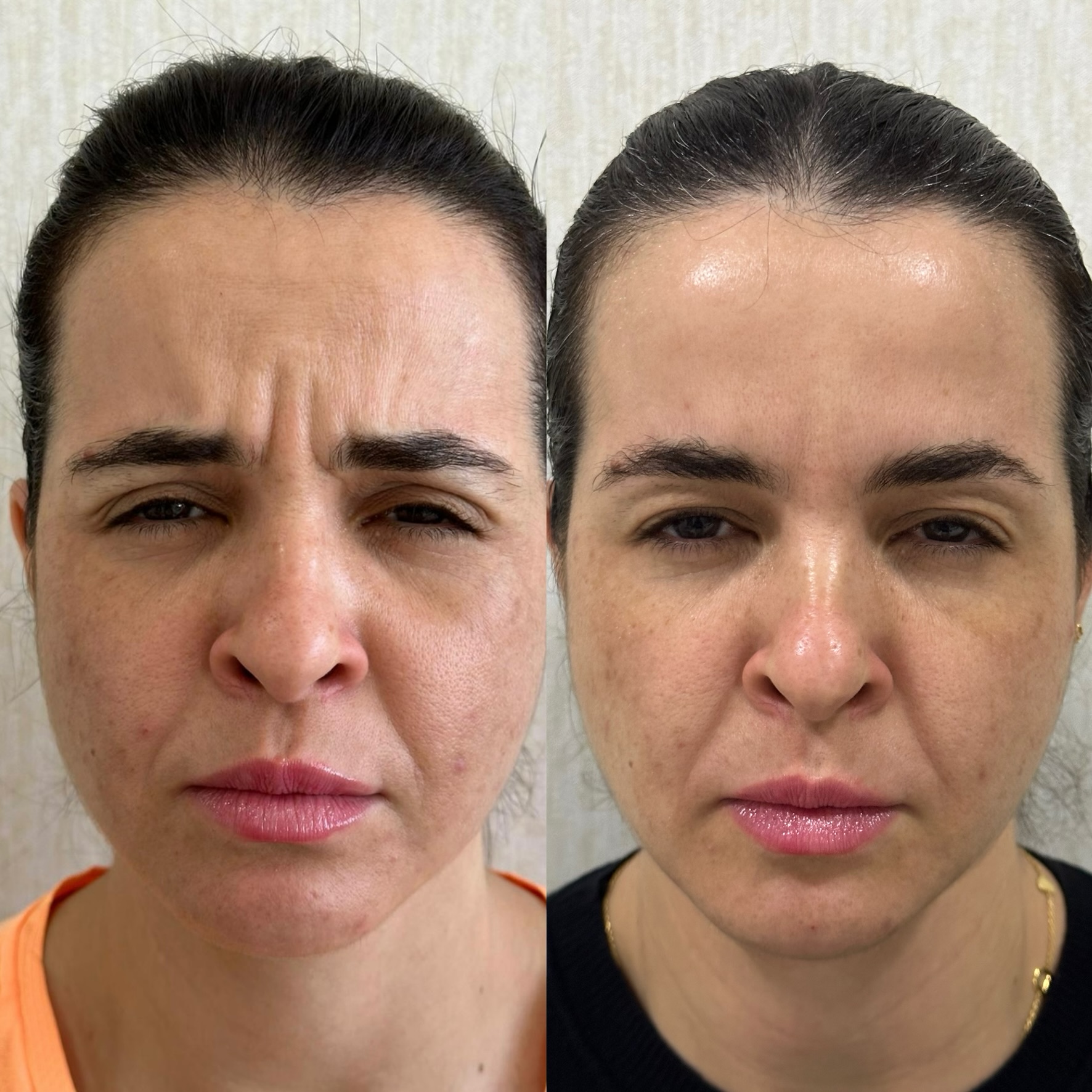 Daya Medspa client photos: A refreshed expression